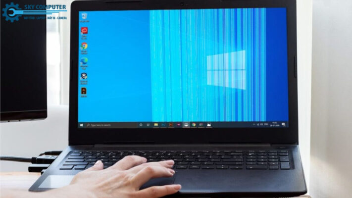 man-hinh-laptop-bi-soc